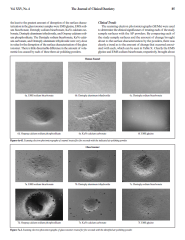 EMS Airflow Tozu 300 g.