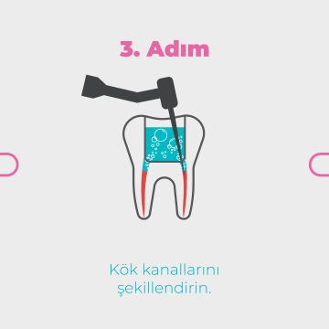 MedCem Dual Rinse HEDP