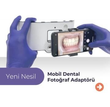 Xpedent Mobil Dental Fotoğraf Adaptörü