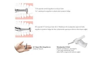 Woodpecker Endo Radar Pro – Apeks Locatorlü Kablosuz Endomotor