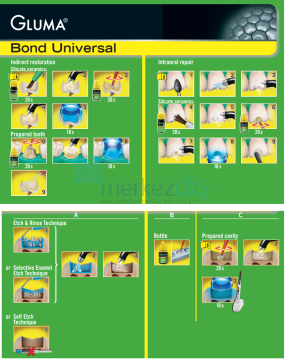 Kulzer Gluma Universal Bond 4 ml