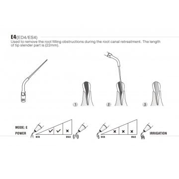 WOODPECKER ULTRASONIC SCALER KAVİTRON UÇ
