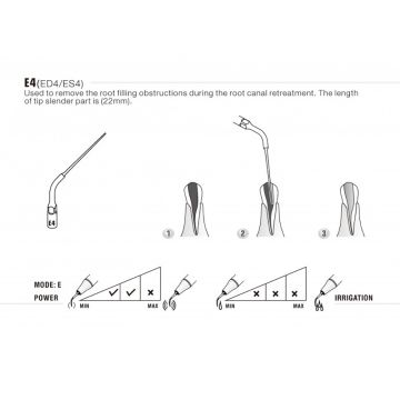 WOODPECKER ULTRASONIC SCALER KAVİTRON UÇ
