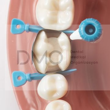 Dentsply CIRCUMFERENTIAL MATRIX SYSTEM Palodent 360