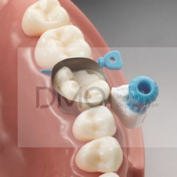 Dentsply CIRCUMFERENTIAL MATRIX SYSTEM Palodent 360