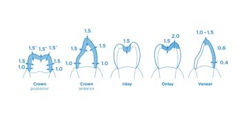 Dentsply Celtra Duo C14 Cerec Cad-Cam Blok 4'lü