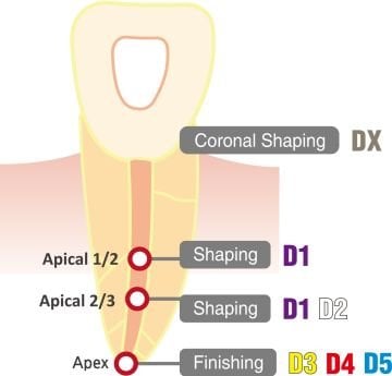 DIADENT Dia-X Kanal Eğesi Protaper Muadili Niti