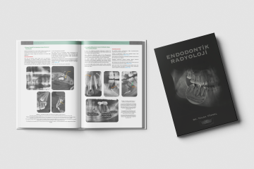 Endodontik Radyoloji - Tolga Yüksel