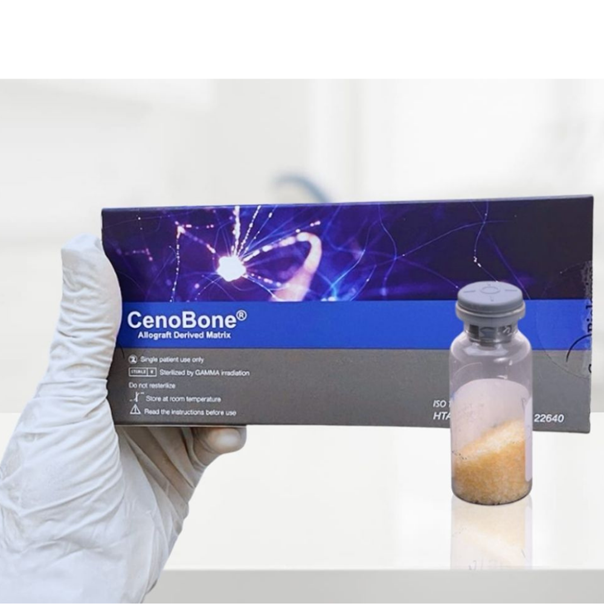 Cenobone 150-1000 Gren Allogretf