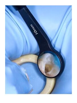 Royva Endodonti Aynası-Micro Mirror 10 mm.