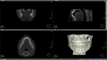 HDX WILL Eco-X Dental Tomografi - CBCT